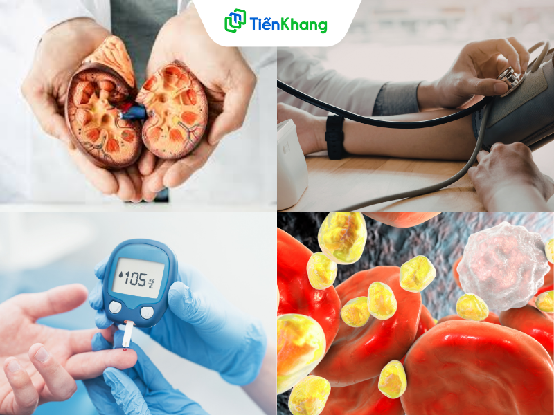 Người có bệnh về thận, huyết áp, tiểu đường và mỡ máu nên lưu ý khi dùng nhiều nước tương