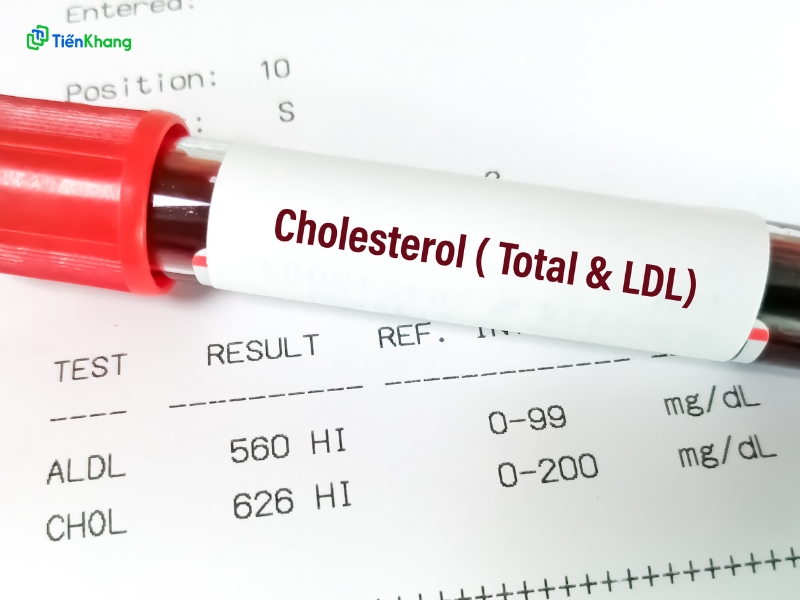 Giảm cholesterol xấu