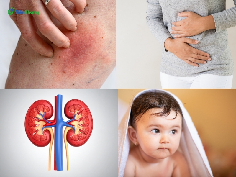Những người không nên dùng đậu xanh
