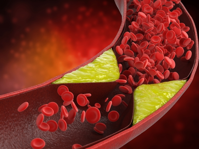 Giảm Cholesterol và mỡ nhiễm trong máu