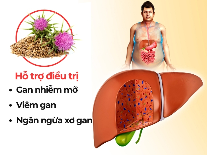 Tác dụng của cây kế sữa đối với bệnh gan